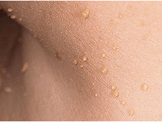 Movie papilloma